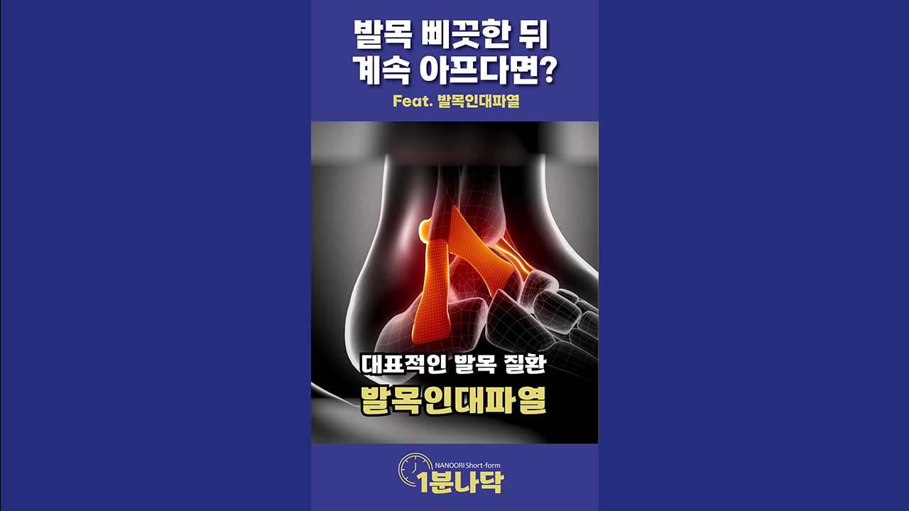 [1분나닥] 발목 삐끗한 뒤 계속 아프다면? (Feat. 발목인대파열)