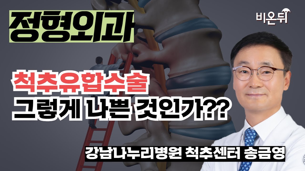 척추유합술, 그렇게 나쁜 것인가?